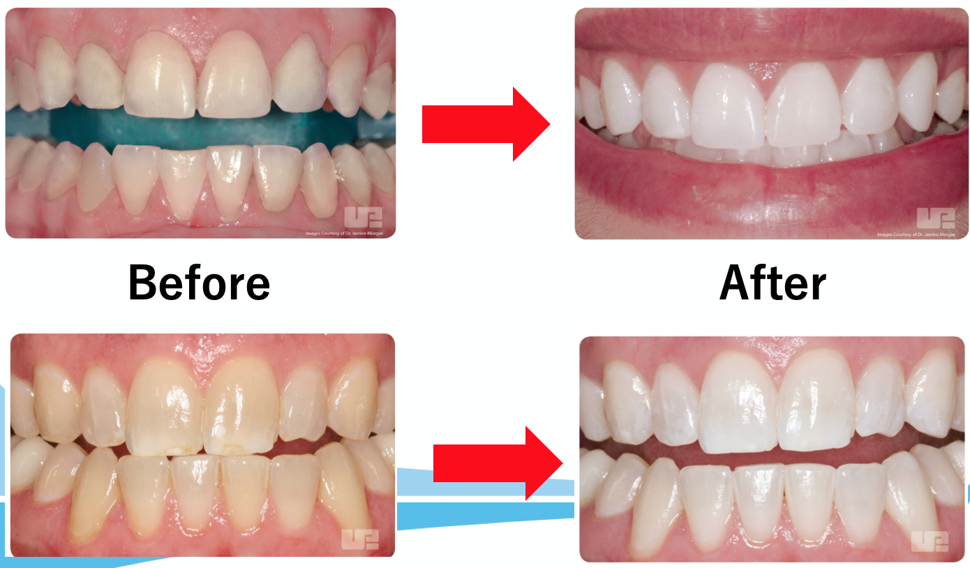 スクリーンショット 2020-03-04 20.10.40